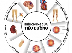 Những biến chứng nguy hiểm của bệnh tiểu đường mà bạn cần biết